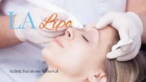 Woman receiving Actinic Keratosis Removal Treatment West Sussex