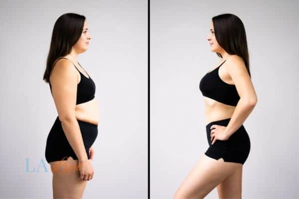LA-EMS Body Sculpting West Sussex results before and after of womans results on body toning.