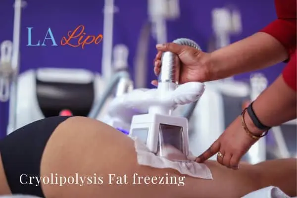 women getting fat freezing West Sussex
