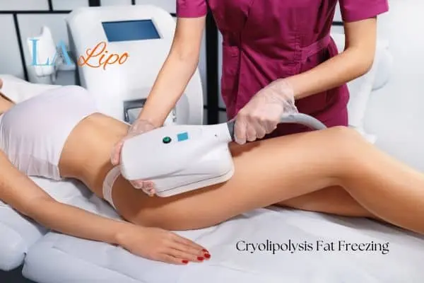 Woman receiving coolsculpting West Sussex treatment on her thighs