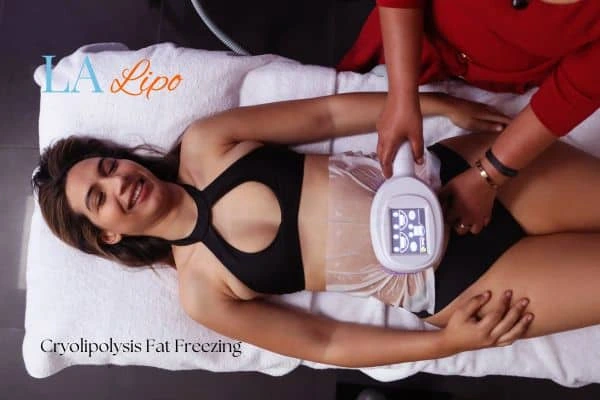 woman getting cryolipolysis West Sussex