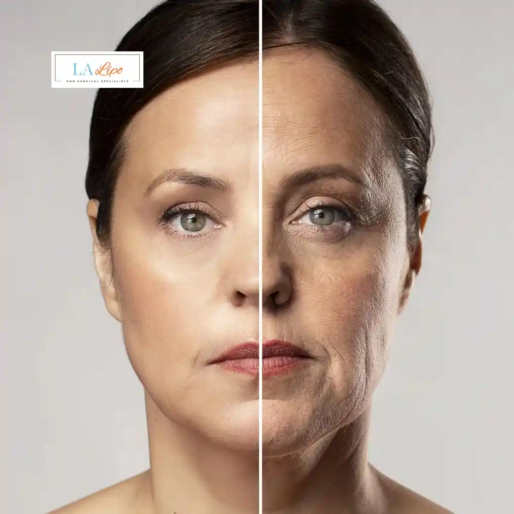 How Can You Tell If Non-Surgical Skin Tightening Is Right for You West Sussex?