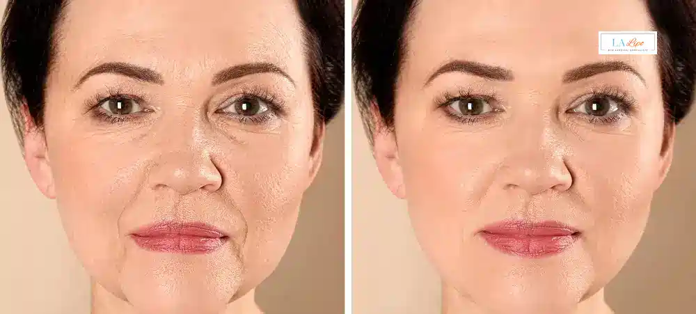 How Long Does It Take to See Results and How Long Do They Last West Sussex?