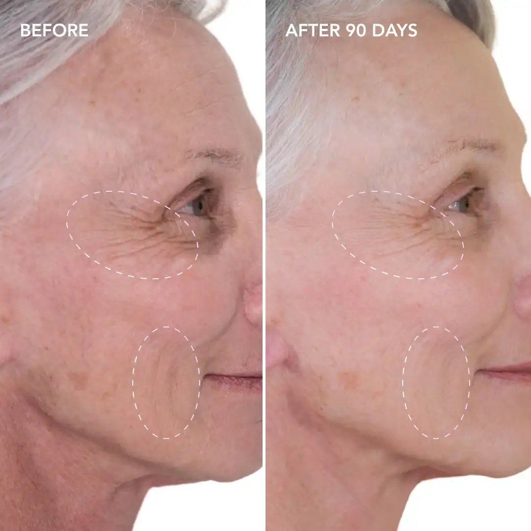 When will you see results West Sussex